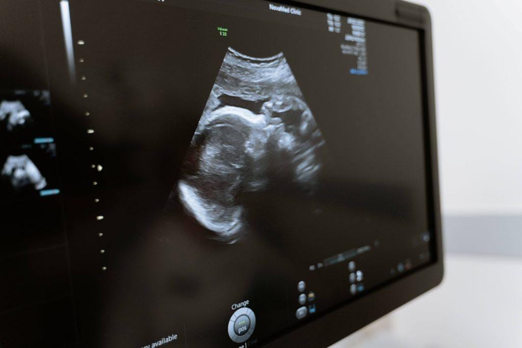 ultrasound machine